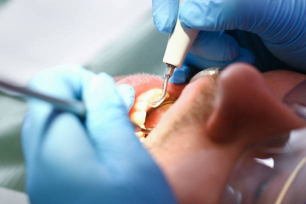Best Same-Day Emergency Dentist in Barnsdall, OK