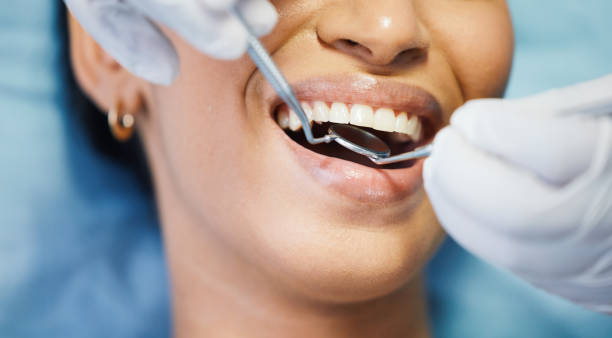 Best Emergency Tooth Extraction in Barnsdall, OK
